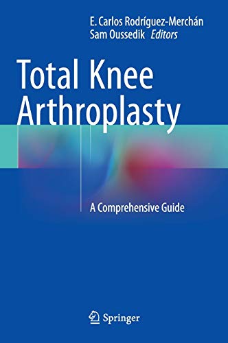 Stock image for Total Knee Arthroplasty : A Comprehensive Guide for sale by Ria Christie Collections