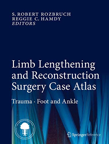 9783319180250: Limb Lengthening and Reconstruction Surgery Case Atlas: Trauma  Foot and Ankle