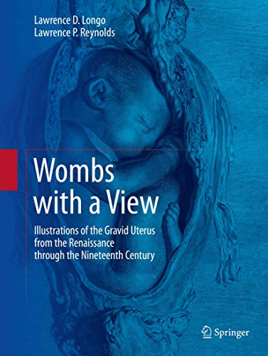 9783319235660: Wombs with a View: Illustrations of the Gravid Uterus from the Renaissance through the Nineteenth Century