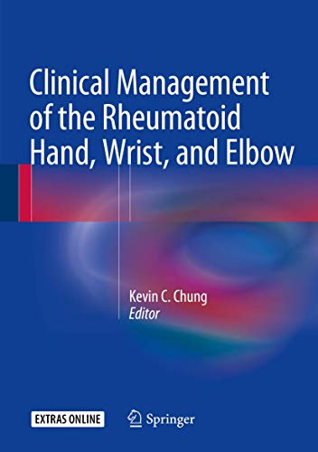 9783319266589: Clinical Management of the Rheumatoid Hand, Wrist, and Elbow