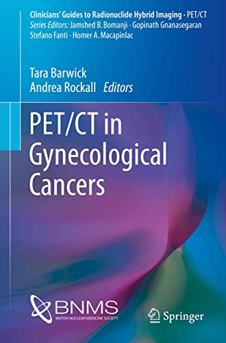 9783319292472: PET/CT in Gynecological Cancers (Clinicians’ Guides to Radionuclide Hybrid Imaging)