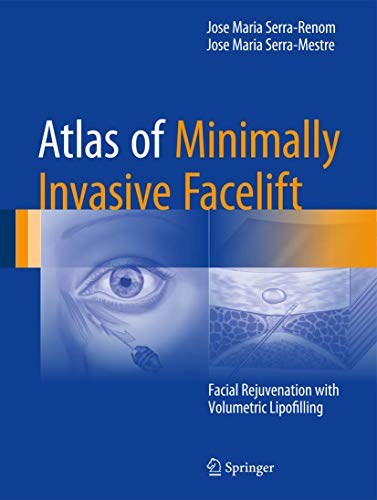 9783319330167: Atlas of Minimally Invasive Facelift: Facial Rejuvenation with Volumetric Lipofilling