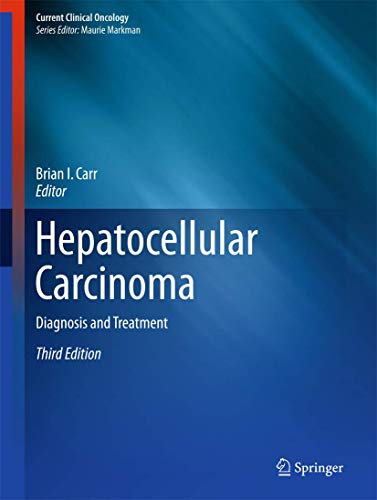 Beispielbild fr Hepatocellular Carcinoma. Diagnosis and Treatment. zum Verkauf von Antiquariat im Hufelandhaus GmbH  vormals Lange & Springer