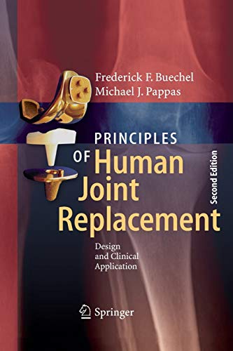 9783319342535: Principles of Human Joint Replacement: Design and Clinical Application