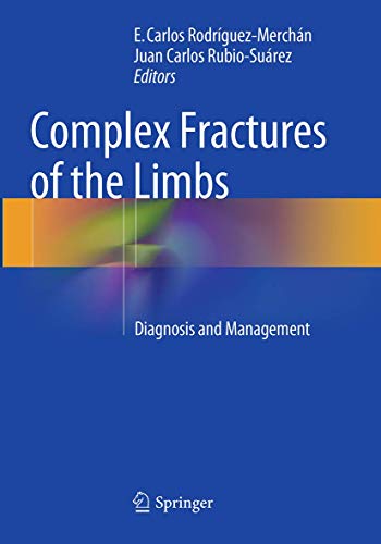 9783319349497: Complex Fractures of the Limbs: Diagnosis and Management