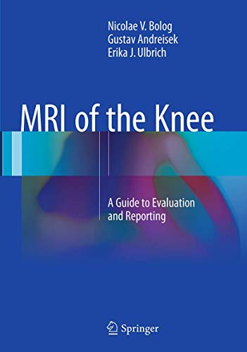 9783319352534: MRI of the Knee: A Guide to Evaluation and Reporting