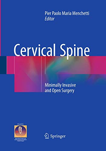 9783319361024: Cervical Spine: Minimally Invasive and Open Surgery