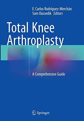 Stock image for Total Knee Arthroplasty: A Comprehensive Guide for sale by Revaluation Books