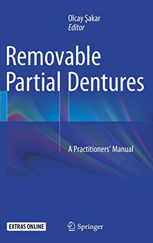 9783319371474: Removable Partial Dentures: A Practitioners’ Manual