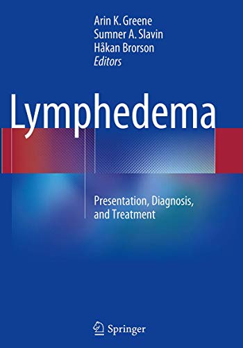 9783319382692: Lymphedema: Presentation, Diagnosis, and Treatment