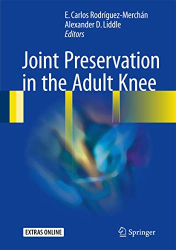 Beispielbild fr Joint Preservation in the Adult Knee. zum Verkauf von Gast & Hoyer GmbH