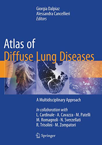 Imagen de archivo de Atlas of Diffuse Lung Diseases a la venta por Blackwell's