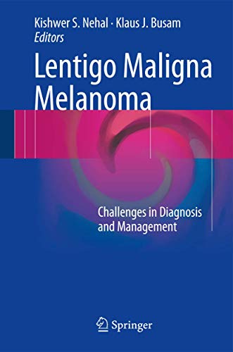 Imagen de archivo de Lentigo Maligna Melanoma. Challenges in Diagnosis and Management. a la venta por Antiquariat im Hufelandhaus GmbH  vormals Lange & Springer