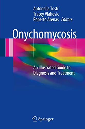 Stock image for Onychomycosis: An Illustrated Guide to Diagnosis and Treatment for sale by GF Books, Inc.