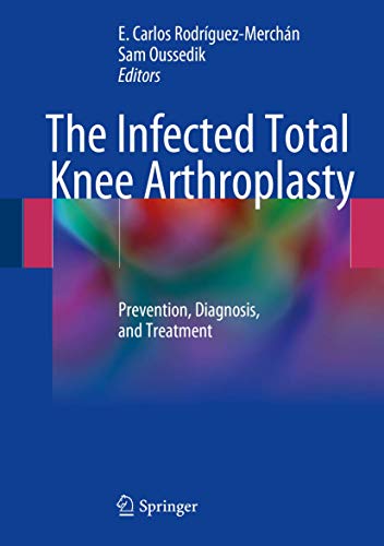 Beispielbild fr The Infected Total Knee Arthroplasty. Prevention, Diagnosis, and Treatment. zum Verkauf von Gast & Hoyer GmbH