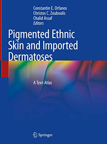 Stock image for Pigmented Ethnic Skin and Imported Dermatoses: A Text-Atlas for sale by SpringBooks