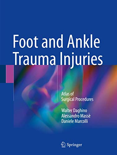 Stock image for Foot and Ankle Trauma Injuries. Atlas of Surgical Procedures. for sale by Gast & Hoyer GmbH