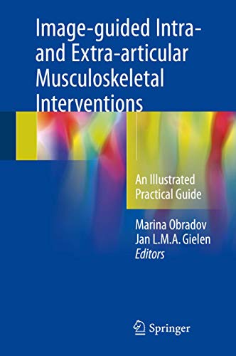 9783319698939: Image-guided Intra- and Extra-articular Musculoskeletal Interventions: An Illustrated Practical Guide