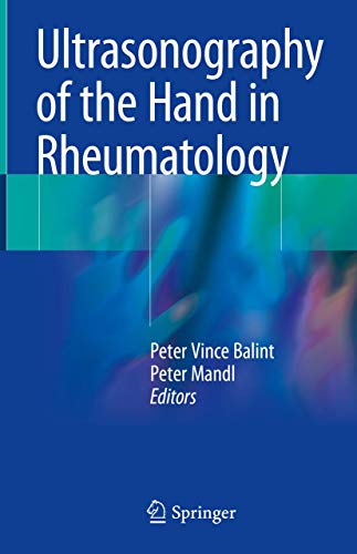 9783319742069: Ultrasonography of the Hand in Rheumatology