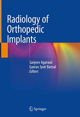 9783319760070: Radiology of Orthopedic Implants