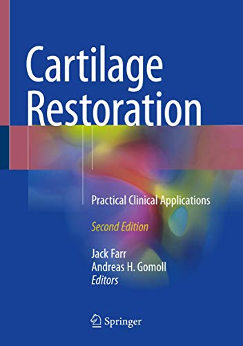 Imagen de archivo de Cartilage Restoration. Practical Clinical Applications. a la venta por Gast & Hoyer GmbH