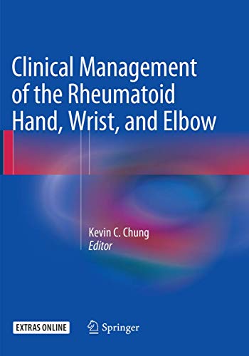 9783319799919: Clinical Management of the Rheumatoid Hand, Wrist, and Elbow