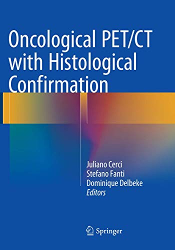 9783319802336: Oncological PET/CT with Histological Confirmation