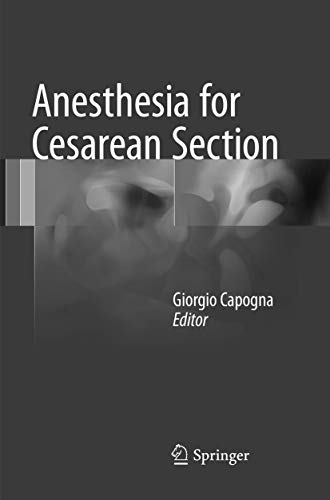 9783319824895: Anesthesia for Cesarean Section