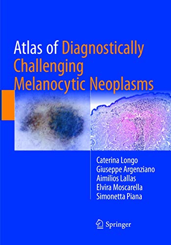 9783319839868: Atlas of Diagnostically Challenging Melanocytic Neoplasms