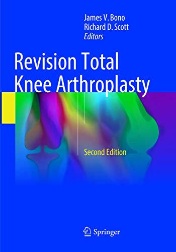 9783319884165: Revision Total Knee Arthroplasty