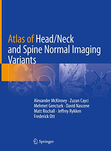 9783319954400: Atlas of Head/Neck and Spine Normal Imaging Variants