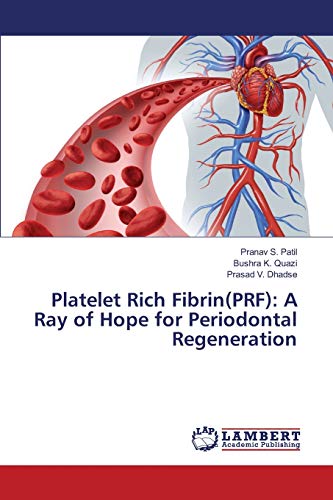 Stock image for Platelet Rich Fibrin(PRF): A Ray of Hope for Periodontal Regeneration for sale by Lucky's Textbooks
