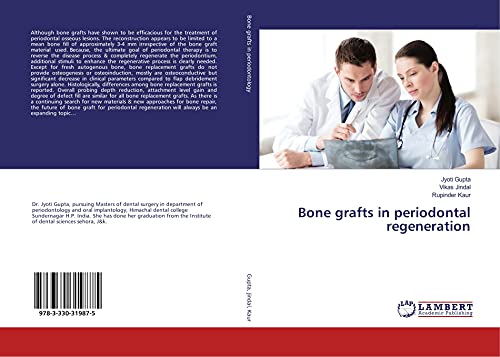 9783330319875: Bone grafts in periodontal regeneration