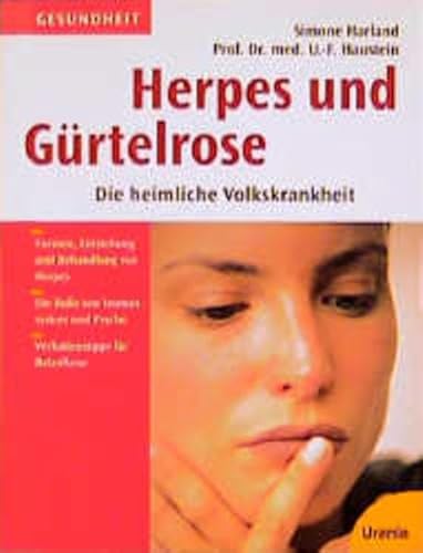 Stock image for Herpes und Grtelrose for sale by medimops