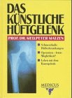 Beispielbild fr Das knstliche Hftgelenk zum Verkauf von Versandantiquariat Felix Mcke