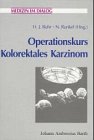 Operationskurs Kolorektales Karzinom