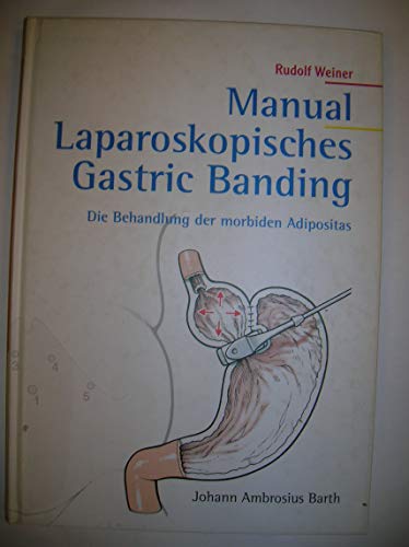Beispielbild fr Manual Laparoskopisches Gastric Banding zum Verkauf von Buch et cetera Antiquariatsbuchhandel
