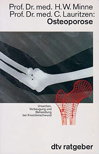 Beispielbild fr Osteoporose von Minne, Helmut W.; Lauritzen, Christian zum Verkauf von Nietzsche-Buchhandlung OHG