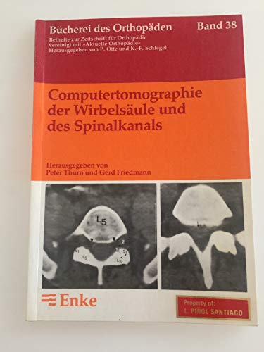 9783432937410: Computertomographie der Wirbelsule und des Spinalkanals