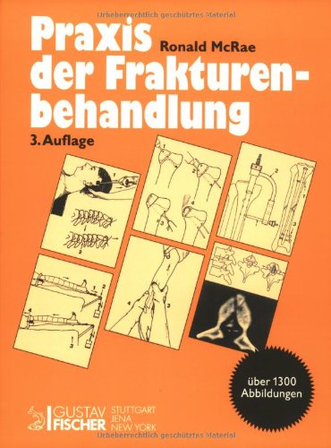 9783437006869: Praxis Der Frakturenbehandlung