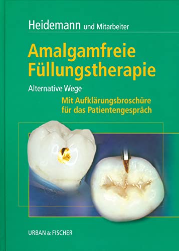 Stock image for Amalgamfreie Fllungstherapie for sale by Bcherpanorama Zwickau- Planitz
