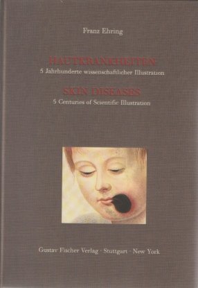 Hautkrankheiten, 5 Jahrhunderte wissenschaftliche Illustration / Skin Diseases, 5 Centuries of Scientific Illustration. - EHRING (Franz)