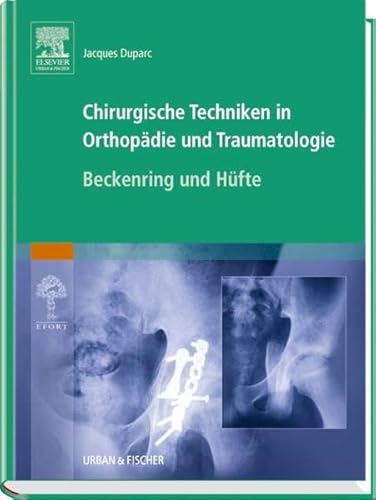 Chirurgische Techniken in Orthopädie und Traumatologie 8 Bände: Chirurgische Techniken in Orthopädie und Traumatologie: Beckenring und Hüfte - Duparc, Jacques