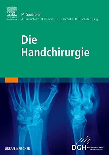 Stock image for Die Handchirurgie for sale by Revaluation Books