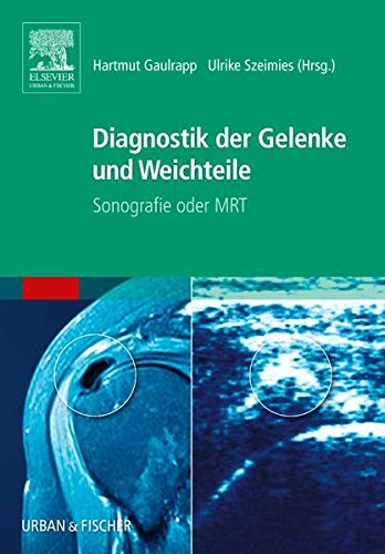 Beispielbild fr Diagnostik der Gelenke und Weichteile: Sonografie oder MRT zum Verkauf von medimops