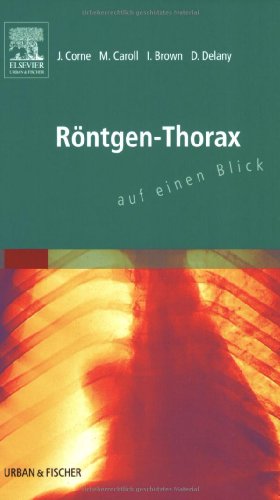 Stock image for Rntgen-Thorax auf einen Blick for sale by medimops