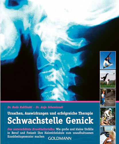 Stock image for Schwachstelle Genick for sale by PBShop.store US