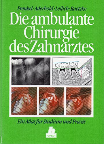 Stock image for Die ambulante Chirurgie des Zahnarztes. Ein Atlas fr Studium und Praxis for sale by medimops