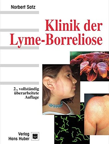 Beispielbild fr Klinik der Lyme-Borreliose. zum Verkauf von ANTIQUARIAT BCHERBERG Martin Walkner