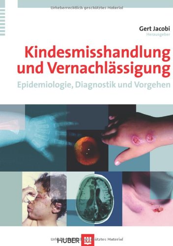 Kindesmisshandlung und Vernachlässigung. Epidemiologie, Diagnostik und Vorgehen - Gert Jacobi (Hrsg.)